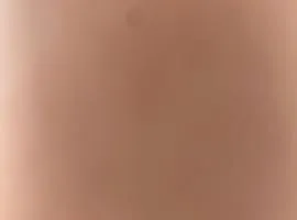 Appart