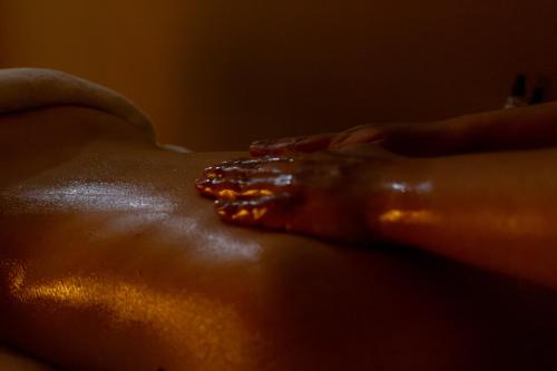 a close up of a persons hand with a rash at In Gold Hotel & Spa in Águeda