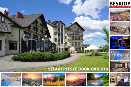 uma colagem de fotografias de um hotel em Hotel Zimnik Luksus Natury Spa & Wellness em Szczyrk
