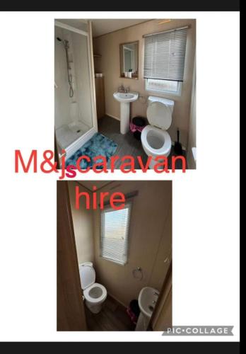 two pictures of a bathroom with two toilets and a sink at M&js caravan hire in Kinmel Bay
