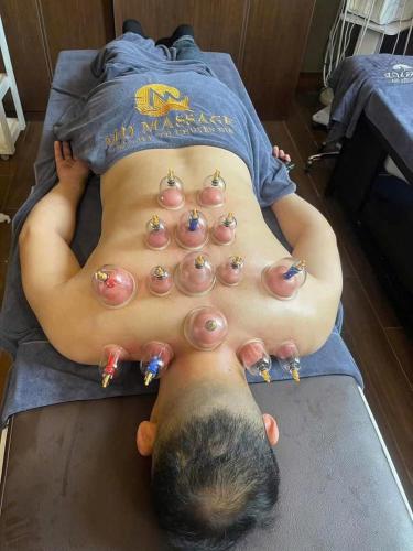 a man laying on his back on a bed with a lot of burns on his at MD Hotel in Mỹ Lộc